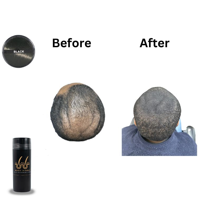 This image showcases the front and top view of Root Fibres hair thickening fibres presented in a stylish black bottle.' Showcasing Professional, Quality, Confident.' Accompanying the main product imageries are before-and-after captions positioned above scalp-focused images, illustrating a thinning head of short black afro texture hair before using Root Fibres hair thickening fibres and the transformative effect after product application, successfully concealing thinning hair or bald spots.