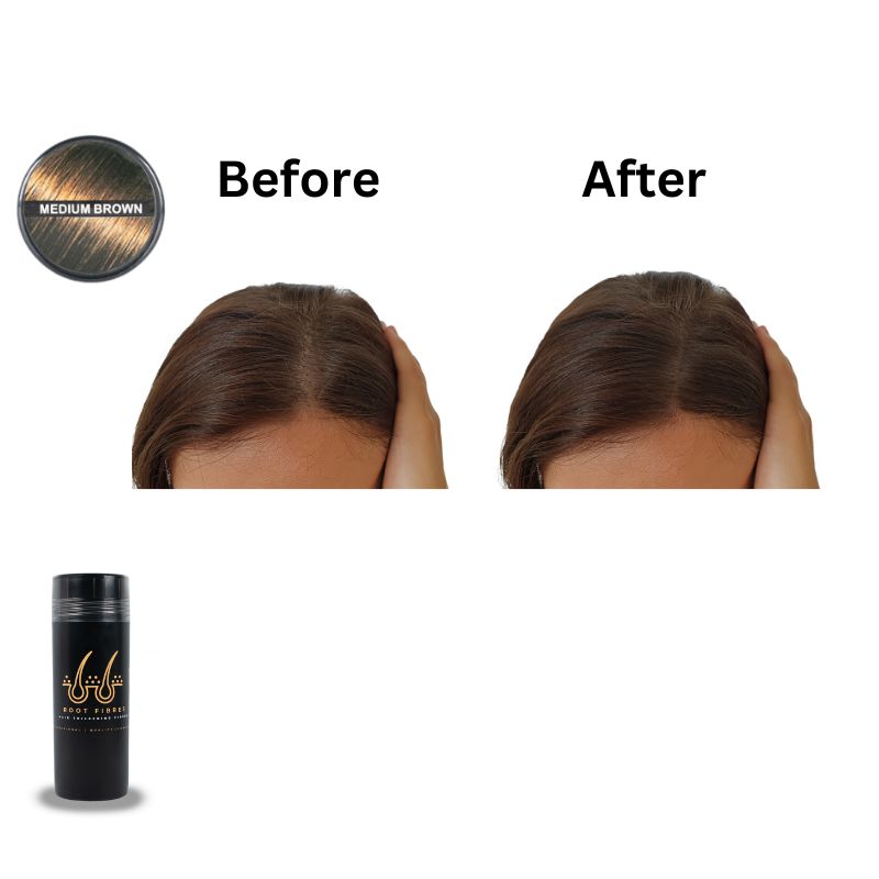 This image showcases the front and top view of Root Fibres hair thickening fibres presented in a stylish black bottle.' Showcasing Professional, Quality, Confident.' Accompanying the main product imageries are before-and-after captions positioned above scalp-focused images, illustrating a thinning head of medium brown thin straight texture hair before using Root Fibres hair thickening fibres and the transformative effect after product application, successfully concealing thinning hair or bald spots.