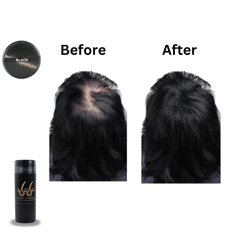 This image showcases the front and top view of Root Fibres hair thickening fibres presented in a stylish black bottle.' Showcasing Professional, Quality, Confident.' Accompanying the main product imageries are before-and-after captions positioned above scalp-focused images, illustrating a thinning head of black thin straight texture hair before using Root Fibres hair thickening fibres and the transformative effect after product application, successfully concealing thinning hair or bald spots.